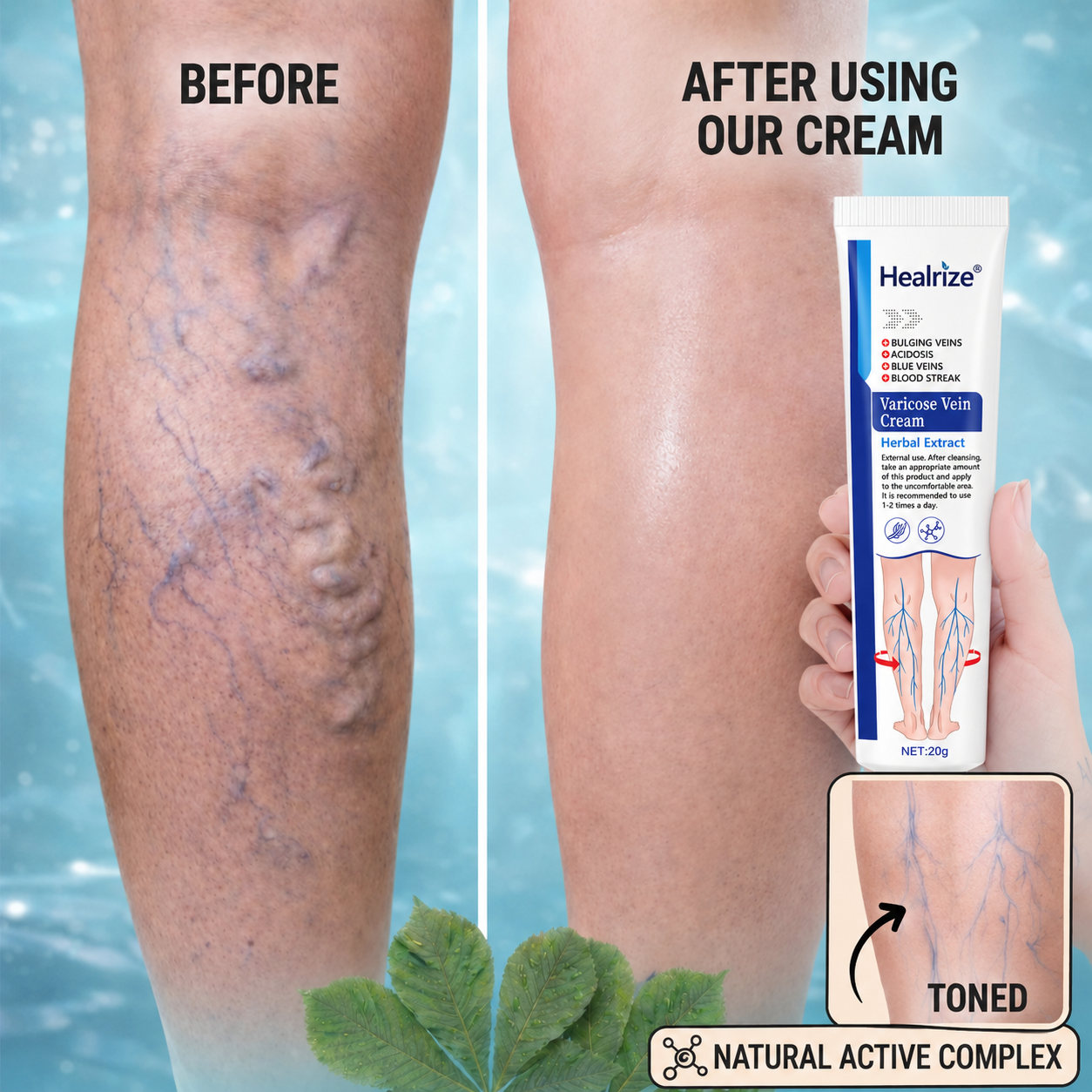 Healrize®Varicose Vein & Circulation Cream – Lighter Legs and Visibly Improved Appearance